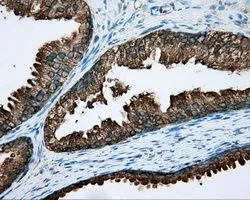 IHC-P analysis of prostate tissue using GTX83716 RDH11 antibody [1B4]. Antigen retrieval : Heat-induced epitope retrieval by 10mM citrate buffer, pH6.0, 100oC for 10min. Dilution : 1:50