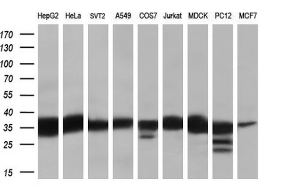 WB analysis of various cell lines using GTX83716 RDH11 antibody [1B4]. Loading : 35 ug per lane Dilution : 1:200