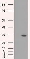WB analysis of HEK293T cells transfected with RDH11 plasmid (Right) or empty vector (Left) for 48 hrs using GTX83716 RDH11 antibody [1B4]. Loading : 5 ug per lane