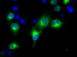 ICC/IF analysis of COS7 cells transiently transfected with RDH11 plasmid using GTX83716 RDH11 antibody [1B4].