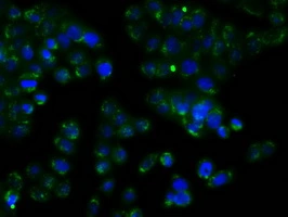 ICC/IF analysis of HT29 cells using GTX83716 RDH11 antibody [1B4].