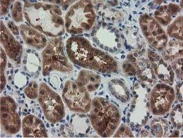 IHC-P analysis of human kidney tissue using GTX83722 RASD2 antibody [1G1].
