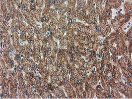 IHC-P analysis of human liver tissue using GTX83722 RASD2 antibody [1G1].