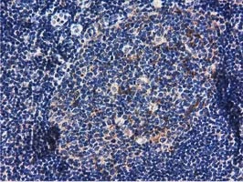 IHC-P analysis of human lymph node tissue using GTX83722 RASD2 antibody [1G1].