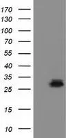 WB analysis of HEK293T cells transfected with RASD2 plasmid (Right) or empty vector (Left) for 48 hrs using GTX83722 RASD2 antibody [1G1]. Loading : 5 ug per lane