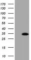 WB analysis of HEK293T cells transfected with RASD2 plasmid (Right) or empty vector (Left) for 48 hrs using GTX83723 RASD2 antibody [1D11]. Loading : 5 ug per lane