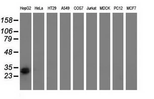 WB analysis of various cell lines using GTX83723 RASD2 antibody [1D11]. Loading : 35 ug per lane