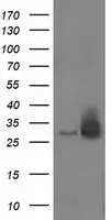 WB analysis of HEK293T cells transfected with RASD2 plasmid (Right) or empty vector (Left) for 48 hrs using GTX83724 RASD2 antibody [1A12]. Loading : 5 ug per lane
