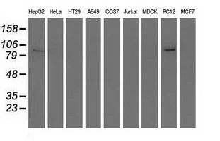 WB analysis of various cell lines using GTX83724 RASD2 antibody [1A12]. Loading : 35 ug per lane