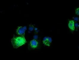 ICC/IF analysis of COS7 cells transiently transfected with RASD2 plasmid using GTX83724 RASD2 antibody [1A12].