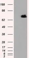 WB analysis of HEK293T cells transfected with RALBP1 plasmid (Right) or empty vector (Left) for 48 hrs using GTX83726 RALBP1 antibody [6C6]. Loading : 5 ug per lane