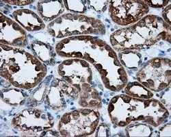 IHC-P analysis of kidney tissue using GTX83734 RALBP1 antibody [2A6]. Antigen retrieval : Heat-induced epitope retrieval by 10mM citrate buffer, pH6.0, 100oC for 10min. Dilution : 1:50