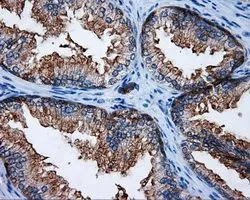 IHC-P analysis of prostate tissue using GTX83734 RALBP1 antibody [2A6]. Antigen retrieval : Heat-induced epitope retrieval by 10mM citrate buffer, pH6.0, 100oC for 10min. Dilution : 1:50