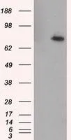 WB analysis of HEK293T cells transfected with RALBP1 plasmid (Right) or empty vector (Left) for 48 hrs using GTX83734 RALBP1 antibody [2A6]. Loading : 5 ug per lane