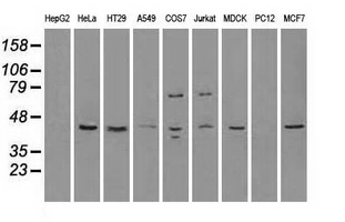 WB analysis of HEK293T cells transfected with RAD9A plasmid (Right) or empty vector (Left) for 48 hrs using GTX83735 RAD9A antibody [5D9]. Loading : 5 ug per lane
