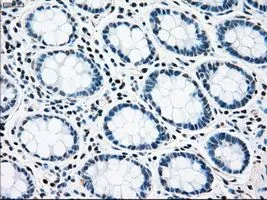 IHC-P analysis of colon tissue using GTX83736 RAD9A antibody [7B11]. Antigen retrieval : Heat-induced epitope retrieval by 10mM citrate buffer, pH6.0, 100oC for 10min. Dilution : 1:50