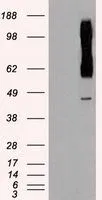 WB analysis of HEK293T cells transfected with RAD9A plasmid (Right) or empty vector (Left) for 48 hrs using GTX83736 RAD9A antibody [7B11]. Loading : 5 ug per lane