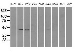 WB analysis of various cell lines using GTX83736 RAD9A antibody [7B11]. Loading : 35 ug per lane