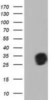 WB analysis of HEK293T cells transfected with QPRT plasmid (Right) or empty vector (Left) for 48 hrs using GTX83744 QPRT antibody [4B4]. Loading : 5 ug per lane
