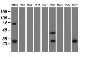 WB analysis of various cell lines using GTX83744 QPRT antibody [4B4]. Loading : 35 ug per lane