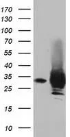 WB analysis of HEK293T cells transfected with PYCR2 plasmid (Right) or empty vector (Left) for 48 hrs using GTX83752 PYCR2 antibody [4A10]. Loading : 5 ug per lane