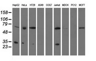 WB analysis of various cell lines using GTX83754 PYCR2 antibody [2F11]. Loading : 35 ug per lane