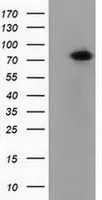 WB analysis of HEK293T cells transfected with PUS7 plasmid (Right) or empty vector (Left) for 48 hrs using GTX83755 PUS7 antibody [4A2]. Loading : 5 ug per lane