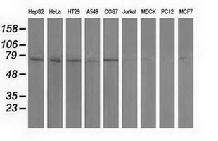 WB analysis of various cell lines using GTX83755 PUS7 antibody [4A2]. Loading : 35 ug per lane