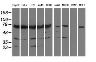 WB analysis of various cell lines using GTX83756 PUS7 antibody [4H5]. Loading : 35 ug per lane