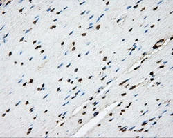 IHC-P analysis of human colon tissue using GTX83767 PTPRE antibody [3D4]. Antigen retrieval : Heat-induced epitope retrieval by 1mM EDTA in 10mM Tris buffer (pH8.5) at 120ooC for 3 min.