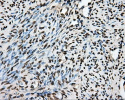 IHC-P analysis of human endometrium tissue using GTX83767 PTPRE antibody [3D4]. Antigen retrieval : Heat-induced epitope retrieval by 1mM EDTA in 10mM Tris buffer (pH8.5) at 120ooC for 3 min.