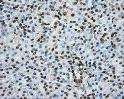 IHC-P analysis of human pancreas tissue using GTX83767 PTPRE antibody [3D4]. Antigen retrieval : Heat-induced epitope retrieval by 1mM EDTA in 10mM Tris buffer (pH8.5) at 120ooC for 3 min.