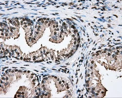 IHC-P analysis of human prostate tissue using GTX83767 PTPRE antibody [3D4]. Antigen retrieval : Heat-induced epitope retrieval by 1mM EDTA in 10mM Tris buffer (pH8.5) at 120ooC for 3 min.