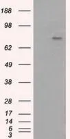 WB analysis of HEK293T cells transfected with PTPRE plasmid (Right) or empty vector (Left) for 48 hrs using GTX83767 PTPRE antibody [3D4]. Loading : 5 ug per lane