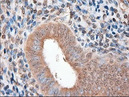 IHC-P analysis of human endometrium tissue using GTX83771 PTCH1 antibody [5c7]. Antigen retrieval : Heat-induced epitope retrieval by 10mM citrate buffer, pH6.0, 100oC for 10min.