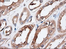 IHC-P analysis of human kidney tissue using GTX83771 PTCH1 antibody [5c7]. Antigen retrieval : Heat-induced epitope retrieval by 10mM citrate buffer, pH6.0, 100oC for 10min.