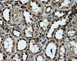 IHC-P analysis of kidney tissue using GTX83784 PSMC3 antibody [1C10]. Antigen retrieval : Heat-induced epitope retrieval by 10mM citrate buffer, pH6.0, 100oC for 10min. Dilution : 1:50