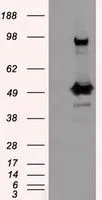 WB analysis of HEK293T cells transfected with PSMC3 plasmid (Right) or empty vector (Left) for 48 hrs using GTX83784 PSMC3 antibody [1C10]. Loading : 5 ug per lane