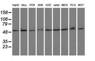 WB analysis of various cell lines using GTX83784 PSMC3 antibody [1C10]. Loading : 35 ug per lane