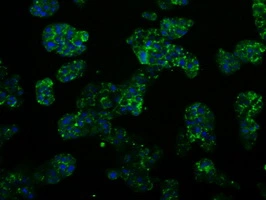 ICC/IF analysis of HepG2 cells using GTX83784 PSMC3 antibody [1C10].