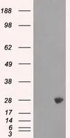 WB analysis of HEK293T cells transfected with PSMA7 plasmid (Right) or empty vector (Left) for 48 hrs using GTX83785 PSMA7 antibody [8F9]. Loading : 5 ug per lane