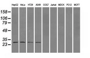 WB analysis of various cell lines using GTX83786 PSMA7 antibody [2A7]. Loading : 35 ug per lane