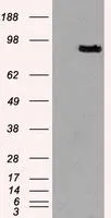 WB analysis of HEK293T cells transfected with PROM2 plasmid (Right) or empty vector (Left) for 48 hrs using GTX83794 PROM2 antibody [3D12]. Loading : 5 ug per lane