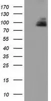 WB analysis of HEK293T cells transfected with PKD2 plasmid (Right) or empty vector (Left) for 48 hrs using GTX83819 PKD2 antibody [3B12]. Loading : 5 ug per lane