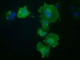 ICC/IF analysis of COS7 cells transiently transfected with PKD2 plasmid using GTX83819 PKD2 antibody [3B12].