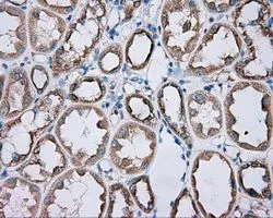 IHC-P analysis of kidney tissue using GTX83823 PKA R2 antibody [1A7]. Antigen retrieval : Heat-induced epitope retrieval by 10mM citrate buffer, pH6.0, 100oC for 10min. Dilution : 1:50