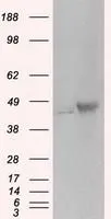 WB analysis of HEK293T cells transfected with PKA R2 plasmid (Right) or empty vector (Left) for 48 hrs using GTX83823 PKA R2 antibody [1A7]. Loading : 5 ug per lane