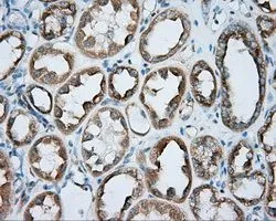 IHC-P analysis of kidney tissue using GTX83825 PKA R2 antibody [4A3]. Antigen retrieval : Heat-induced epitope retrieval by 10mM citrate buffer, pH6.0, 100oC for 10min. Dilution : 1:50