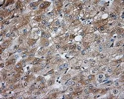 IHC-P analysis of liver tissue using GTX83825 PKA R2 antibody [4A3]. Antigen retrieval : Heat-induced epitope retrieval by 10mM citrate buffer, pH6.0, 100oC for 10min. Dilution : 1:50