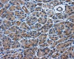 IHC-P analysis of pancreas tissue using GTX83825 PKA R2 antibody [4A3]. Antigen retrieval : Heat-induced epitope retrieval by 10mM citrate buffer, pH6.0, 100oC for 10min. Dilution : 1:50